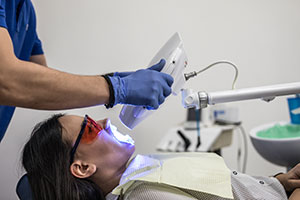 Para el blanqueamiento dental usamos lámpara de luz led, última tecnología