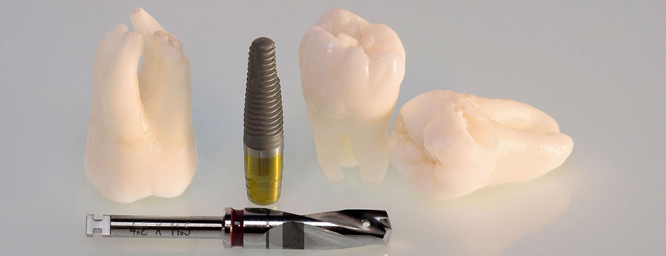 Diferentes componentes y herramientas utilizadas en la colocación de implantes dentales